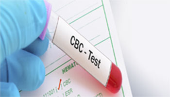 cbc test Lab in Delhi